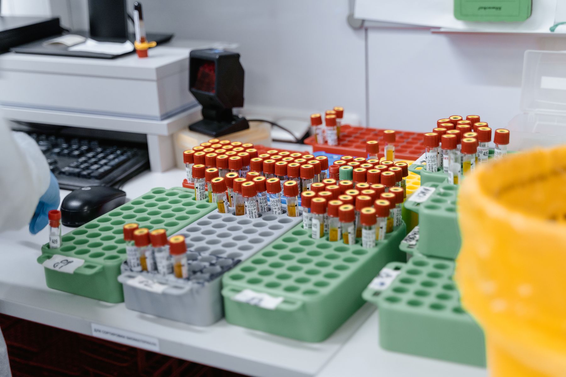 Blood samples arranged for laboratory analysis
